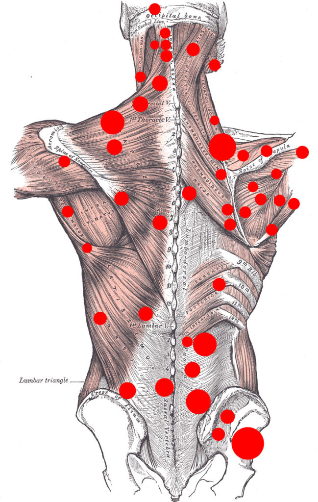 Image of massage therapy pain points
